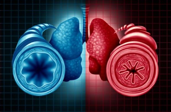 Kronik Tromboembolik Pulmoner Hipertansiyon